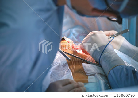 Closeup of professional doctor hands operating a patient during open heart surgery in surgical room. Healthcare and medical intervention concept Closeup of professional doctor hands operating a patient during open heart surgery in surgical room. Healthcare and medical intervention concept 115800780