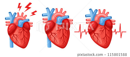 Human heart internal organ, cardiac muscle anatomy, heartache, cardiology medicine, heartbeat pulse. Cardiovascular attack disease treatment, medical cardiogram. Body blood system. Health care vector  115801588