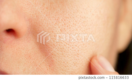 skin texture with enlarged pores. Problem skin. part of a woman face. acne. skin, pore, face, dry, acne skin texture with enlarged pores. Problem skin. part of a woman face. acne. skin, pore, face, dry, acne 115816633