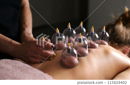 Vacuum Cupping Massage For Young Woman Line On A Massage Table Vacuum Cupping Massage For Young Woman Line On A Massage Table 115828402