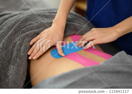 Close up physiotherapist applying applying kinesio tape therapeutic on the patient lower back 115841317