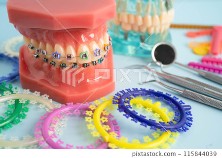 Orthodontic ligatures rings and ties, elastic rubber bands on orthodontic braces, model for dentist studying about dentistry. Orthodontic ligatures rings and ties, elastic rubber bands on orthodontic braces, model for dentist studying about dentistry. 115844039