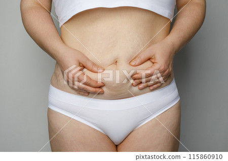 Closeup women waist with thick fat tummy. Female abdomen, lady plus size big belly 115860910