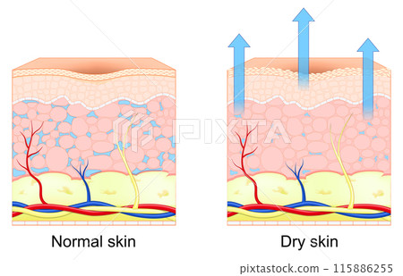 Dry and normal human skin. 115886255