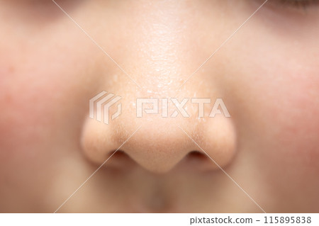 孩子鼻子流汗 115895838