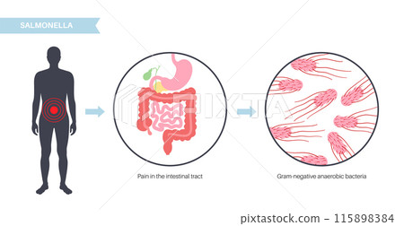 .Salmonella Typhimurium Cells .Salmonella Typhimurium Cells 115898384