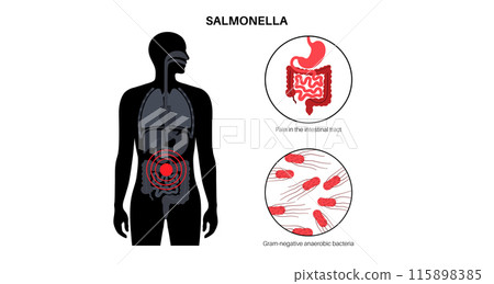 .Salmonella Typhimurium Cells .Salmonella Typhimurium Cells 115898385