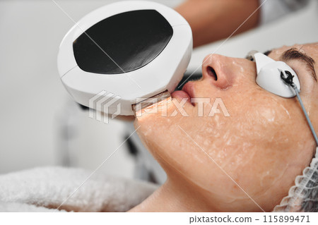 A woman receives IPL therapy in a beauty salon. A woman receives IPL therapy in a beauty salon. 115899471