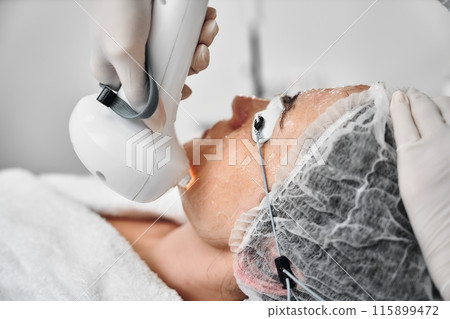 A woman receives IPL therapy in a beauty salon. 115899472