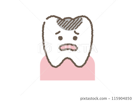 有蛀牙的牙齒的插圖 115904850