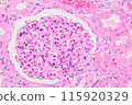 Kidney cells (HE staining) 115920329