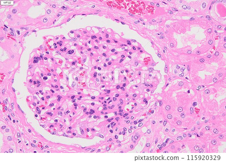 Kidney cells (HE staining) Kidney cells (HE staining) 115920329
