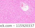 Liver tissue (HE staining) 115920337