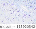 Brain cells (KB staining) 115920342
