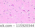 Brain cells (HE staining) 115920344