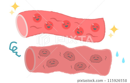 Illustration of blood vessels: clear blood and thick blood 115926558