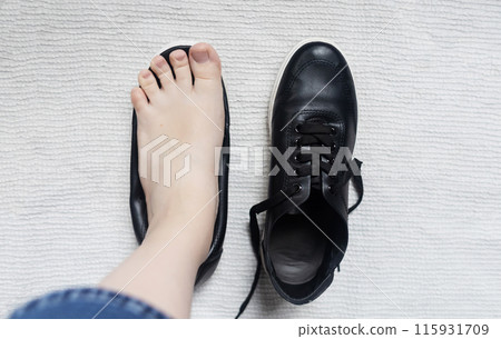 Foot deforming shoes. Incorrect anatomical shoes with flat soles. Small insole size, which causes foot pain. Cause of valgus, calluses, ingrown toenails 115931709