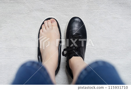 Foot deforming shoes. Incorrect anatomical shoes with flat soles. Small insole size, which causes foot pain. Cause of valgus, calluses, ingrown toenails 115931710