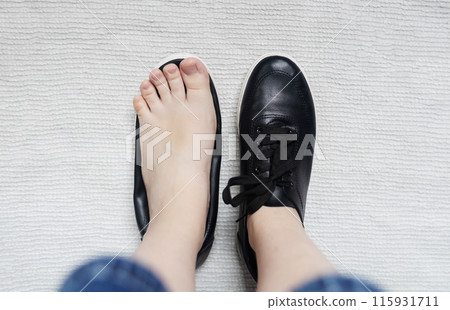Foot deforming shoes. Incorrect anatomical shoes with flat soles. Small insole size, which causes foot pain. Cause of valgus, calluses, ingrown toenails 115931711