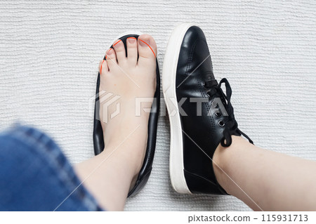 Foot deforming shoes. Incorrect anatomical shoes with flat soles. Small insole size, which causes foot pain. Cause of valgus, calluses, ingrown toenails 115931713
