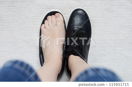Foot deforming shoes. Incorrect anatomical shoes with flat soles. Small insole size, which causes foot pain. Cause of valgus, calluses, ingrown toenails 115931715