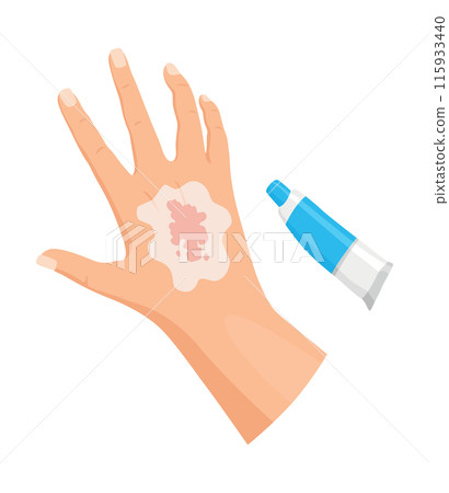 Hands injured skin and procedures of wound cleaning. First aid for wound. Medicine cure or treatment. First emergency help for human hand trauma 115933440