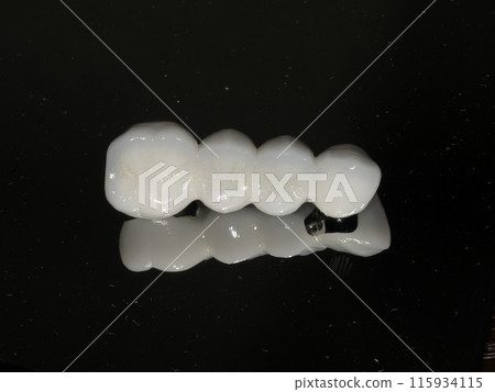 Ceramics Ceramics 115934115