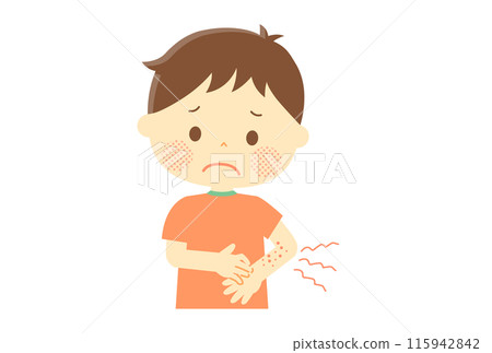 一個男孩手臂上長了蕁麻疹 一個男孩手臂上長了蕁麻疹 115942842