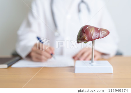 Doctor with human Liver anatomy model. Liver cancer and Tumor, Jaundice, Viral Hepatitis A, B, C, D, E, Cirrhosis, Failure, Enlarged, Hepatic Encephalopathy, Ascites Fluid in Belly and health concept 115949374