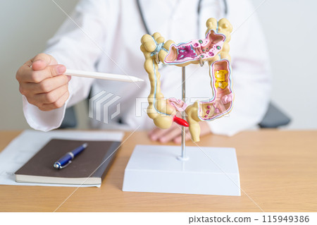 Doctor with human Colon anatomy model. Colonic disease, Large Intestine, Colorectal cancer, Ulcerative colitis, Diverticulitis, Irritable bowel syndrome, Digestive system and Health concept Doctor with human Colon anatomy model. Colonic disease, Large Intestine, Colorectal cancer, Ulcerative colitis, Diverticulitis, Irritable bowel syndrome, Digestive system and Health concept 115949386