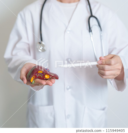 Doctor holding human Liver anatomy model. Liver cancer and Tumor, Jaundice, Viral Hepatitis A, B, C, D, E, Cirrhosis, Failure, Enlarged, Hepatic Encephalopathy, Ascites Fluid in Belly and health Doctor holding human Liver anatomy model. Liver cancer and Tumor, Jaundice, Viral Hepatitis A, B, C, D, E, Cirrhosis, Failure, Enlarged, Hepatic Encephalopathy, Ascites Fluid in Belly and health 115949405