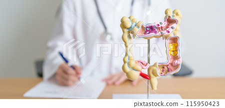 Doctor with human Colon anatomy model. Colonic disease, Large Intestine, Colorectal cancer, Ulcerative colitis, Diverticulitis, Irritable bowel syndrome, Digestive system and Health concept Doctor with human Colon anatomy model. Colonic disease, Large Intestine, Colorectal cancer, Ulcerative colitis, Diverticulitis, Irritable bowel syndrome, Digestive system and Health concept 115950423