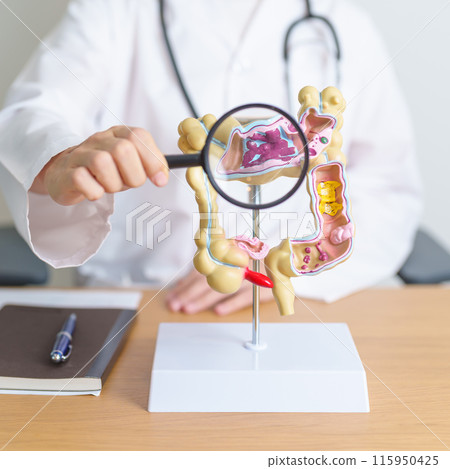 Doctor with human Colon anatomy model and magnifying glass. Colonic disease, Large Intestine, Colorectal cancer, Ulcerative colitis, Diverticulitis, Irritable bowel syndrome and Digestive system 115950425