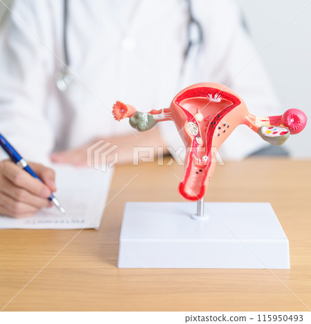 Doctor with Uterus and Ovaries anatomy model. Ovarian and Cervical cancer, Cervix disorder, Endometriosis, Hysterectomy, Uterine fibroids, Reproductive system, Pregnancy and health concept 115950493
