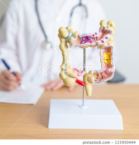 Doctor with human Colon anatomy model. Colonic disease, Large Intestine, Colorectal cancer, Ulcerative colitis, Diverticulitis, Irritable bowel syndrome, Digestive system and Health concept Doctor with human Colon anatomy model. Colonic disease, Large Intestine, Colorectal cancer, Ulcerative colitis, Diverticulitis, Irritable bowel syndrome, Digestive system and Health concept 115950494