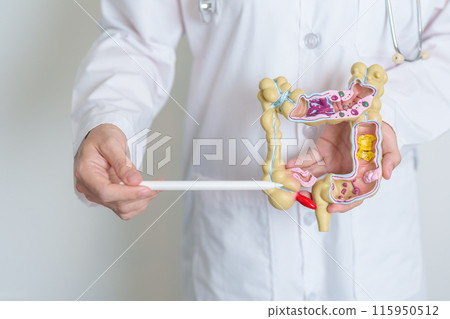Doctor holding human Colon anatomy model. Colonic disease, Large Intestine, Colorectal cancer, Ulcerative colitis, Diverticulitis, Irritable bowel syndrome, Digestive system and Health concept Doctor holding human Colon anatomy model. Colonic disease, Large Intestine, Colorectal cancer, Ulcerative colitis, Diverticulitis, Irritable bowel syndrome, Digestive system and Health concept 115950512
