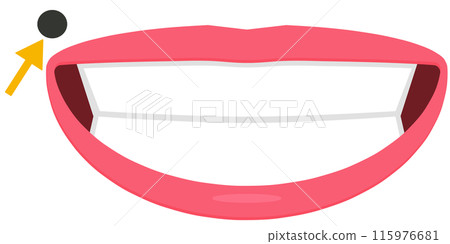 Mole near the mouth Mole near the mouth 115976681