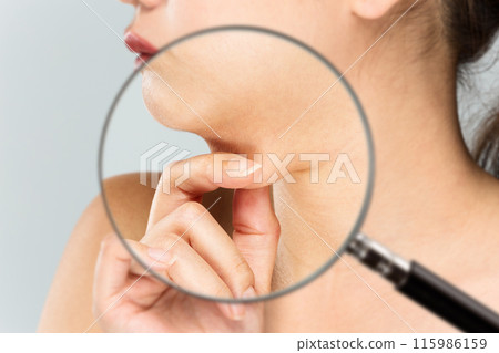 A magnifying glass zooms in on the fat on a woman's chin. 115986159