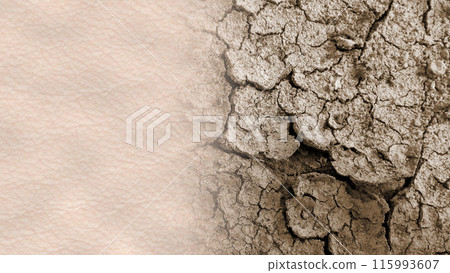 Dry dehydrated skin concept illustration. Comparison of normal healthy skin and dry cracked desert soil. Ad for skin care moisturizer cream or other cosmetic products 115993607