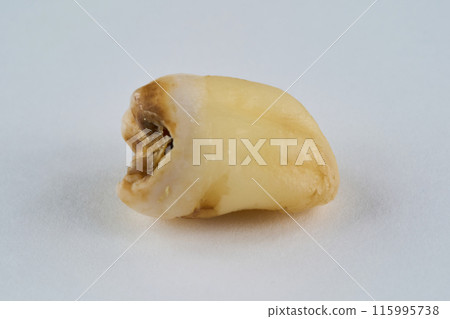 拔出的牙齒和白色背景 拔出的牙齒和白色背景 115995738