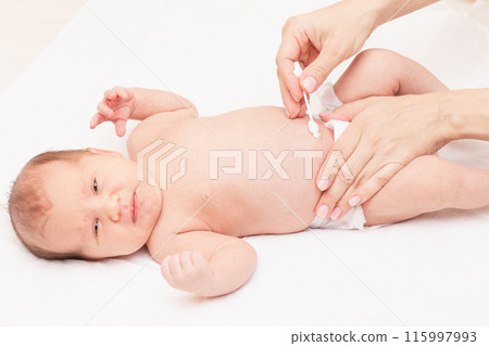 Mother wipes newborn baby navel with cotton swab Mother wipes newborn baby navel with cotton swab 115997993
