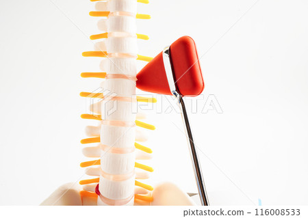 Spinal nerve and bone with knee reflex hammer, Lumbar spine displaced herniated disc fragment, Model for treatment medical in the orthopedic department. Spinal nerve and bone with knee reflex hammer, Lumbar spine displaced herniated disc fragment, Model for treatment medical in the orthopedic department. 116008533