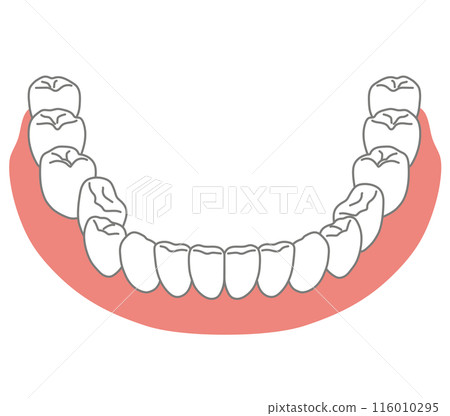 Lower jaw dentition with misaligned teeth - Brushing teeth Lower jaw dentition with misaligned teeth - Brushing teeth 116010295