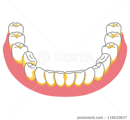 牙菌斑容易殘留的區域：刷牙、剩菜 116010637