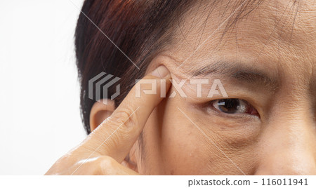 The ptosis or droopy eyelids in asian senior woman. The ptosis or droopy eyelids in asian senior woman. 116011941