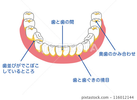 牙菌斑容易殘留的區域：刷牙、剩菜 116012144