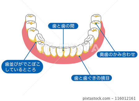 牙菌斑容易殘留的區域：刷牙、剩菜 116012161