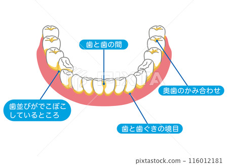 牙菌斑容易殘留的區域：刷牙、剩菜 116012181
