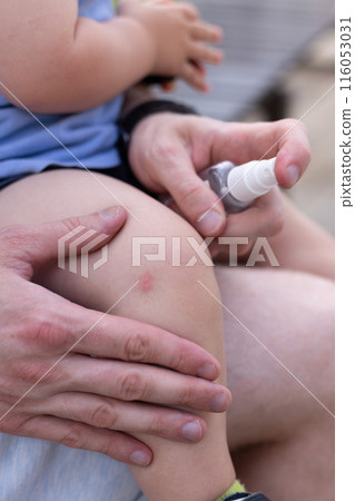 Father spraying antiseptic to the knee of the child sitting on the bench in the park. 116053031