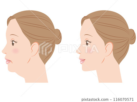 下巴下垂 下巴下垂 116070571